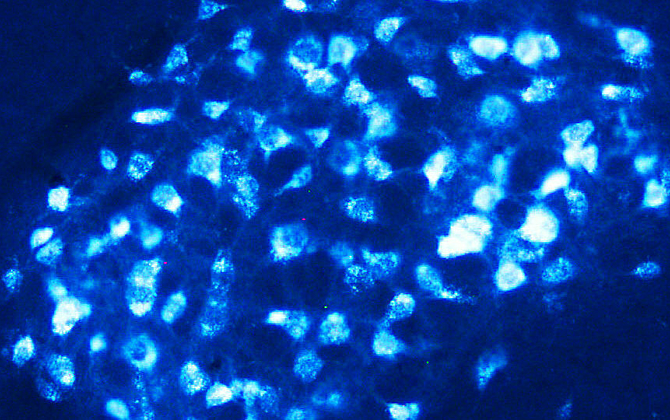 mycoplasma dapi